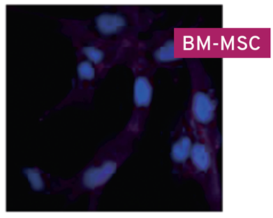 Human bone marrow_BM-MSC